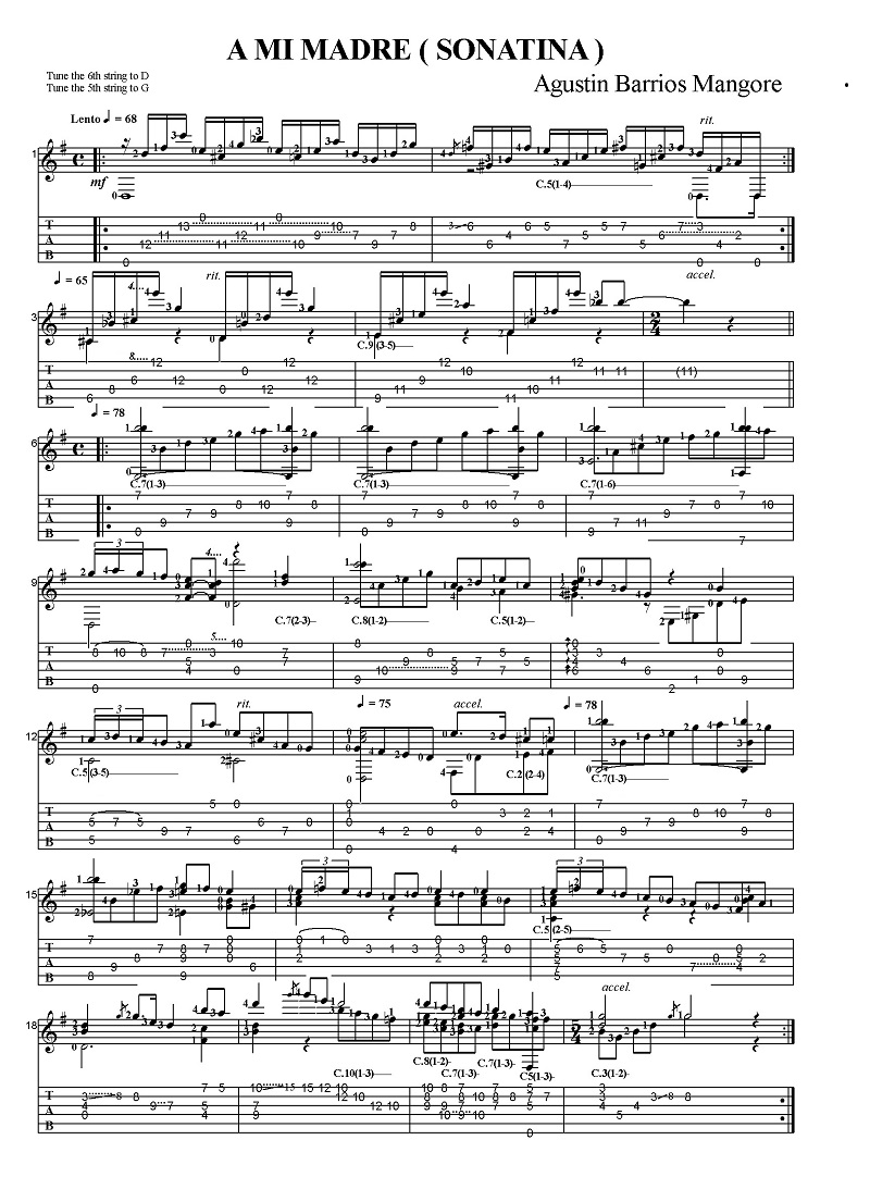 �A�O�X�e�B���E�o���I�X���}���S���@�\�i�`�l�u�킪��Ɂv