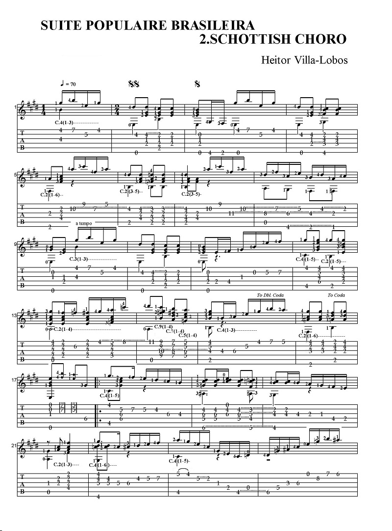 �G�C�g���E���B�������{�X�@�u���W�����w�g�� 2.�V���e�B�b�V���E�V���[��